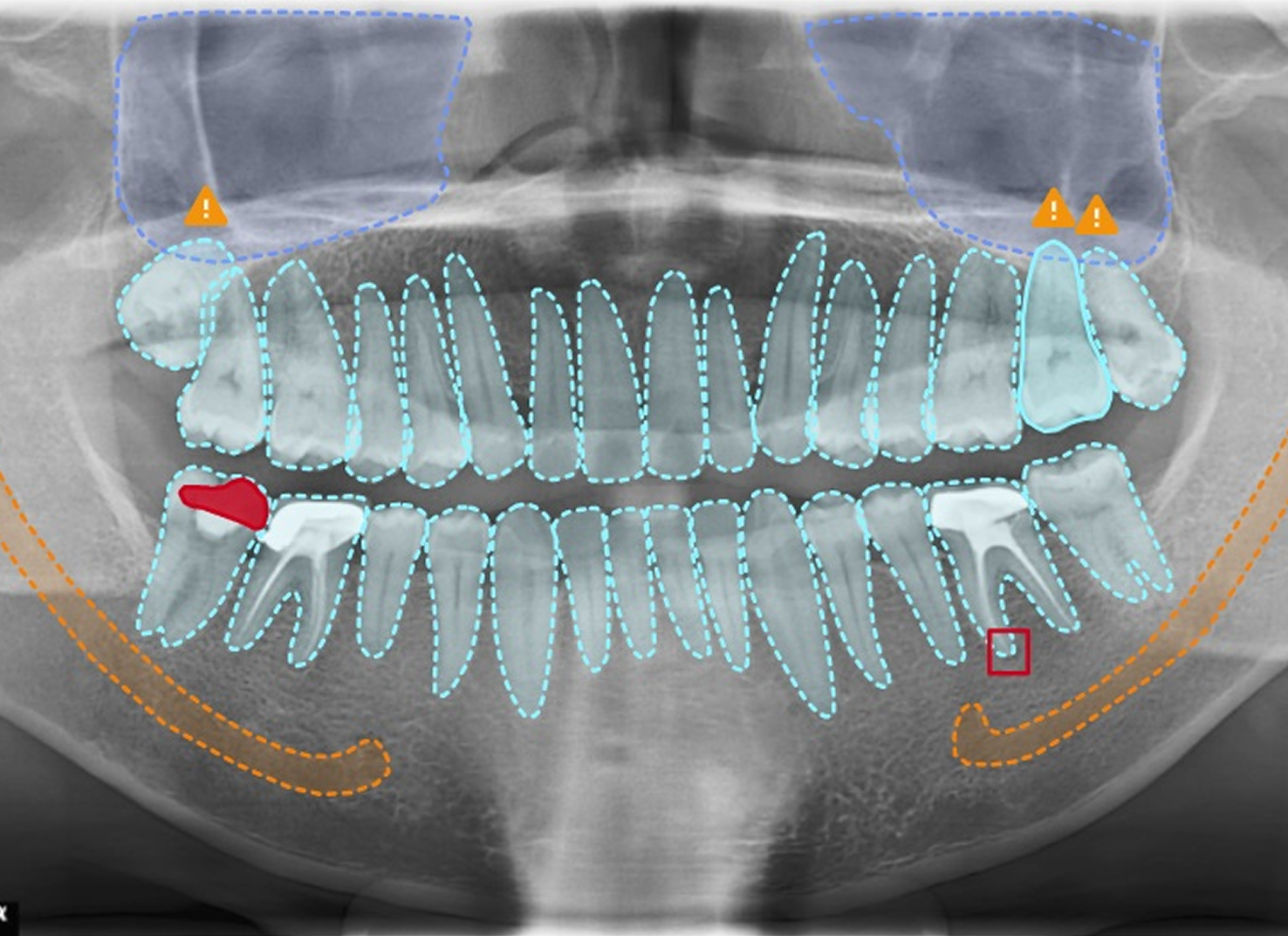 Vici Dentia AI Analysis