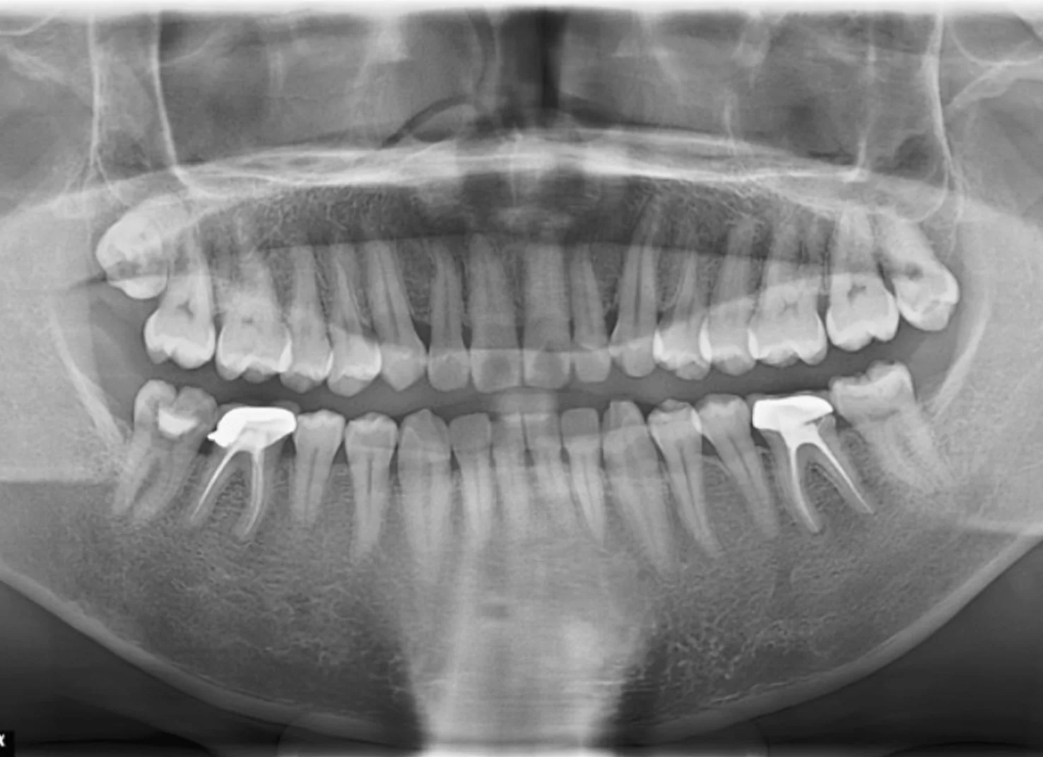 Vici Dentia AI Analysis