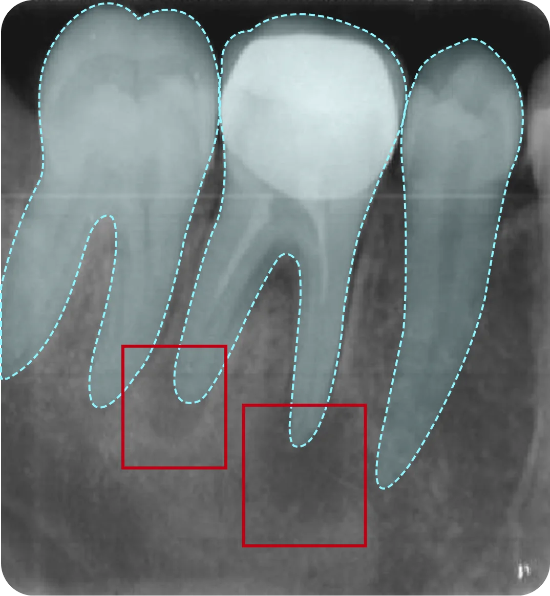 Vici Dentia Dental Imaging