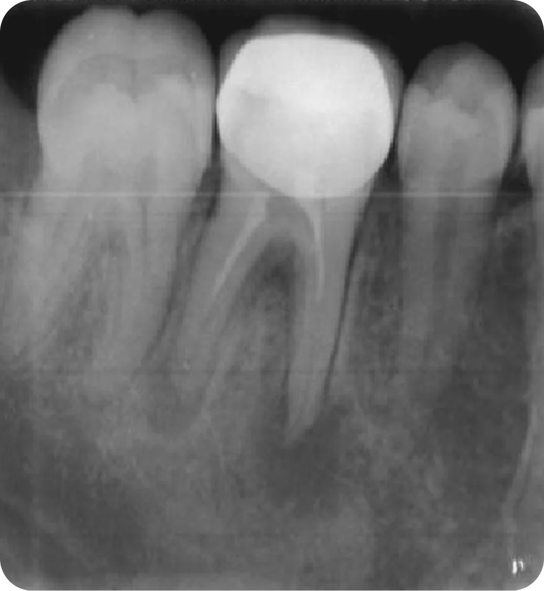 Vici Dentia Dental Imaging