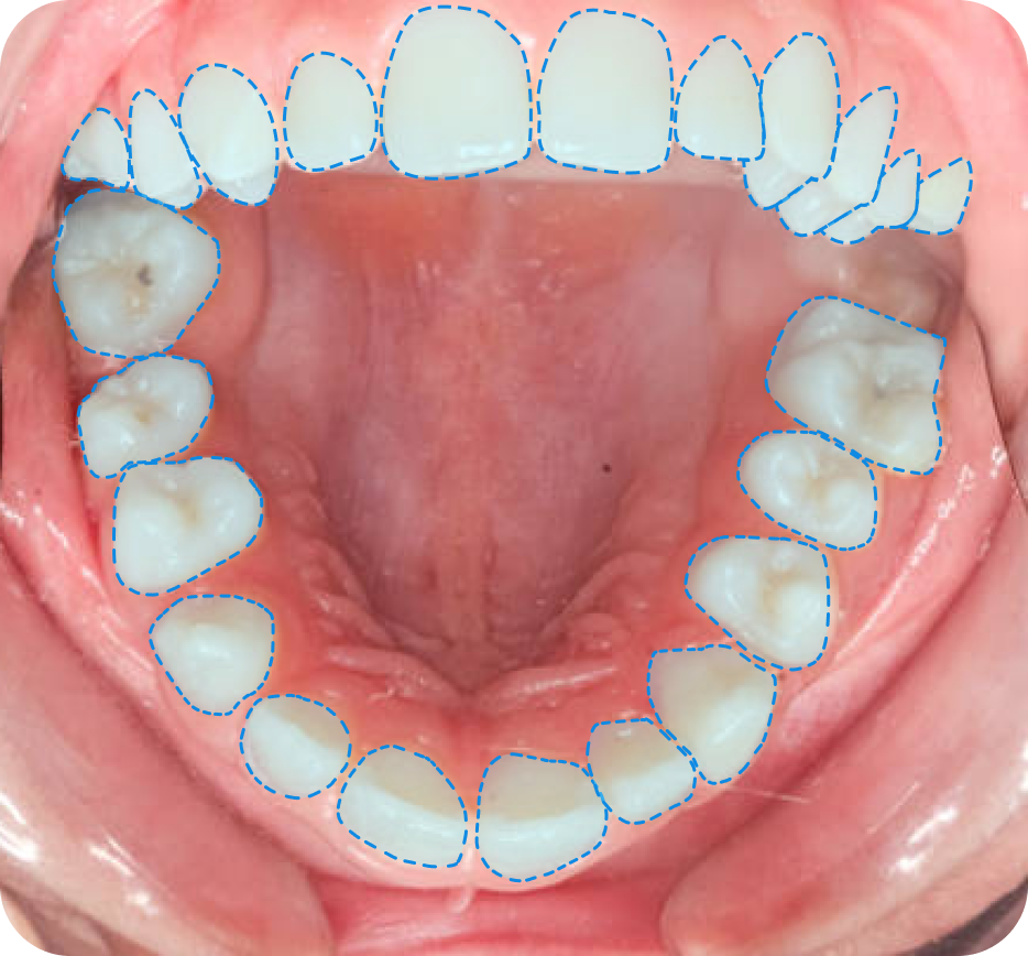 Vici Dentia Dental Imaging