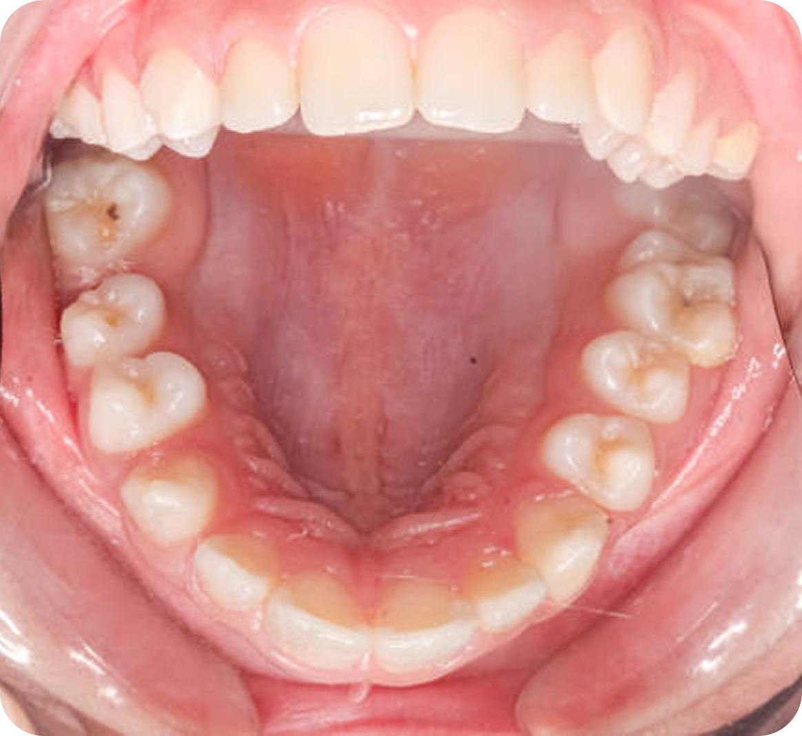 Vici Dentia Dental Imaging