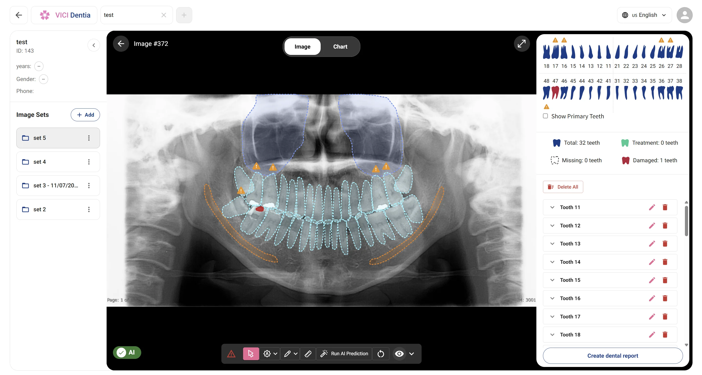 Video giới thiệu VICI Dentia